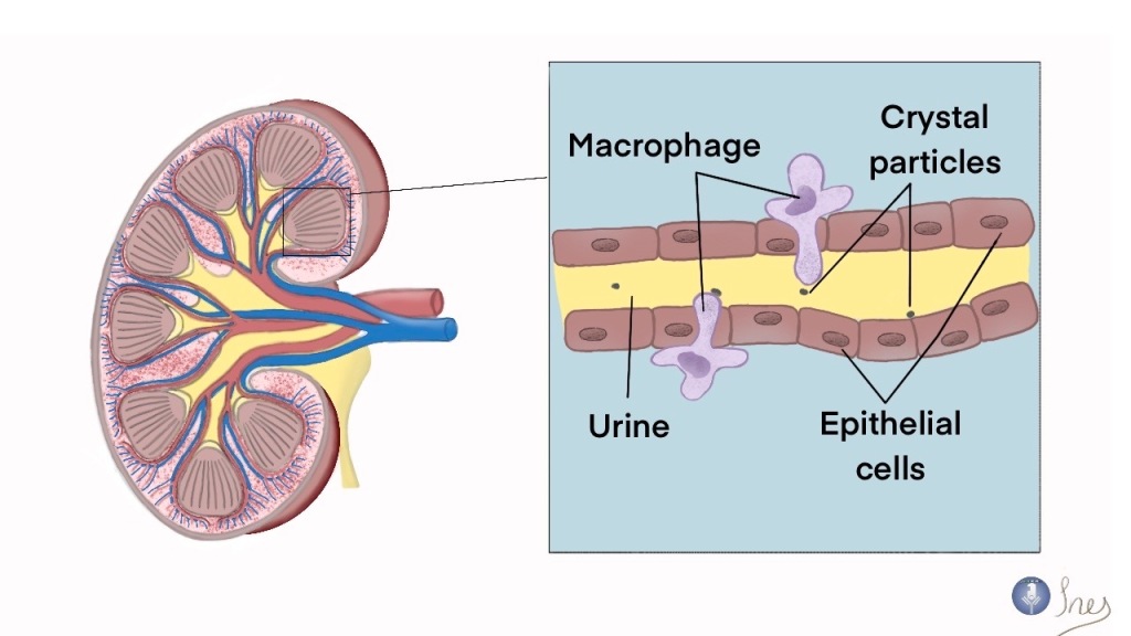Macrophages prevent your renal system from clogging